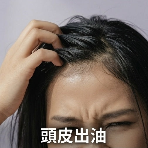 頭髮敏感出油